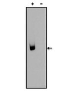 Digoxin Antibody in Western Blot (WB)