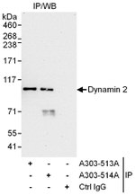 Dynamin 2 Antibody in Immunoprecipitation (IP)
