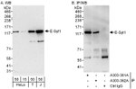 E-Syt1 Antibody in Western Blot (WB)