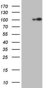 ECT2 Antibody in Western Blot (WB)