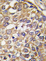 EGFR Antibody in Immunohistochemistry (IHC)