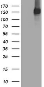 EGFR Antibody in Western Blot (WB)