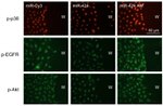 Phospho-EGFR (Tyr845) Antibody in Immunocytochemistry (ICC/IF)