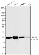 eIF5A Antibody in Western Blot (WB)