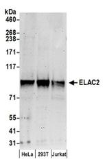 ELAC2 Antibody in Western Blot (WB)