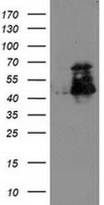 ELK3 Antibody in Western Blot (WB)