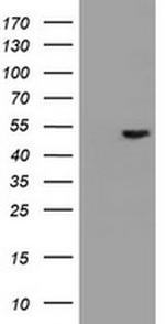 EPHX1 Antibody in Western Blot (WB)