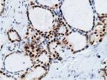 EPM2AIP1 Antibody in Immunohistochemistry (Paraffin) (IHC (P))