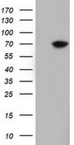 EPM2AIP1 Antibody in Western Blot (WB)