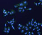 HER2/ErbB2 Antibody in Immunocytochemistry (ICC/IF)