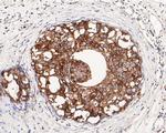 HER2/ErbB2 Antibody in Immunohistochemistry (Paraffin) (IHC (P))