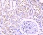 EGFR Antibody in Immunohistochemistry (Paraffin) (IHC (P))