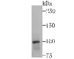 LAMP2a Antibody in Western Blot (WB)