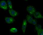 LOXL2 Antibody in Immunocytochemistry (ICC/IF)