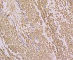 LOXL2 Antibody in Immunohistochemistry (Paraffin) (IHC (P))