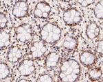 Nucleoporin p62 Antibody in Immunohistochemistry (Paraffin) (IHC (P))