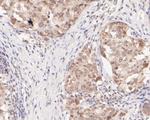 Nucleoporin p62 Antibody in Immunohistochemistry (Paraffin) (IHC (P))