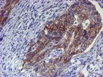 ERBB2 Antibody in Immunohistochemistry (Paraffin) (IHC (P))