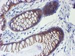 ERBB2 Antibody in Immunohistochemistry (Paraffin) (IHC (P))