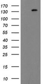 ERBB2 Antibody in Western Blot (WB)