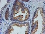 ESR1 Antibody in Immunohistochemistry (Paraffin) (IHC (P))