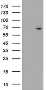 ESR1 Antibody in Western Blot (WB)