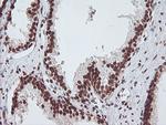 EXOSC7 Antibody in Immunohistochemistry (Paraffin) (IHC (P))