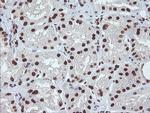 EXOSC7 Antibody in Immunohistochemistry (Paraffin) (IHC (P))