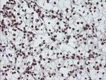 EXOSC7 Antibody in Immunohistochemistry (Paraffin) (IHC (P))