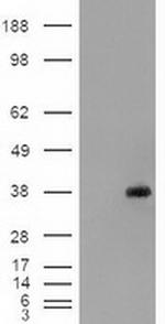 EpCAM Antibody in Western Blot (WB)