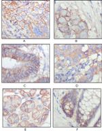 EphB3 Antibody in Immunohistochemistry (Paraffin) (IHC (P))