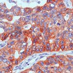 EGFR Antibody in Immunohistochemistry (Paraffin) (IHC (P))