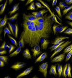 Mouse IgG (H+L) Cross-Adsorbed Secondary Antibody in Immunocytochemistry (ICC/IF)