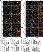 Phospho-FAK (Tyr397) Antibody in Immunocytochemistry (ICC/IF)