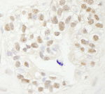 FBW7 Antibody in Immunohistochemistry (IHC)