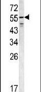 FIBB Antibody in Western Blot (WB)