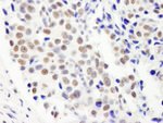 FIP1 Antibody in Immunohistochemistry (IHC)