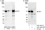 FIP1 Antibody in Western Blot (WB)