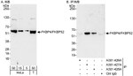 FKBP4/FKBP52 Antibody in Western Blot (WB)