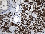 FLJ33360 Antibody in Immunohistochemistry (Paraffin) (IHC (P))