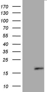 FLJ33360 Antibody in Western Blot (WB)