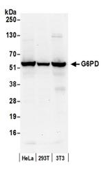 G6PD Antibody in Western Blot (WB)