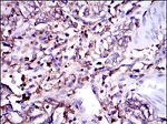 G6PD Antibody in Immunohistochemistry (Paraffin) (IHC (P))