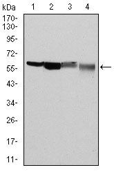 G6PD Antibody in Western Blot (WB)