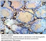 GADD34 Antibody in Immunohistochemistry (IHC)