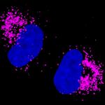 Rabbit IgG (H+L) Highly Cross-Adsorbed Secondary Antibody in Immunocytochemistry (ICC/IF)