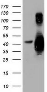 GAS7 Antibody in Western Blot (WB)