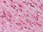 GATA3 Antibody in Immunohistochemistry (Paraffin) (IHC (P))