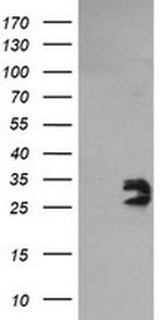 GBAS Antibody in Western Blot (WB)