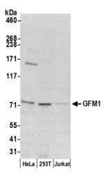 GFM1 Antibody in Western Blot (WB)